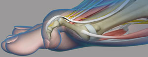 Common Toe Deformities